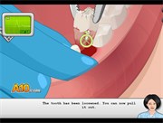Chơi game Thử làm nha sỹ Operate Now Dental Implant